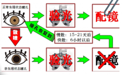 孩子配眼镜散瞳测量吗散瞳验光需要
